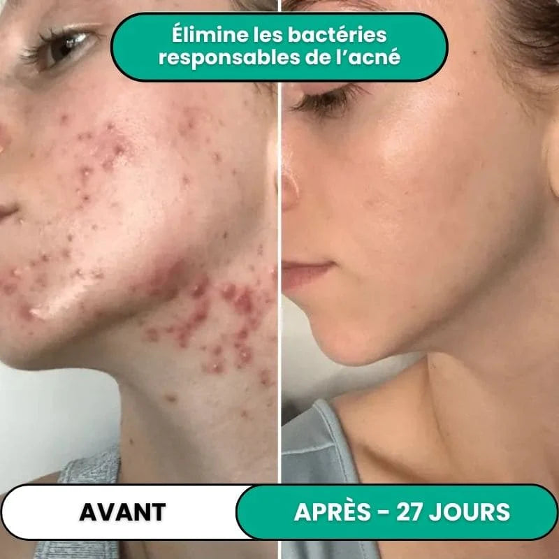 Soin Haute Fréquence