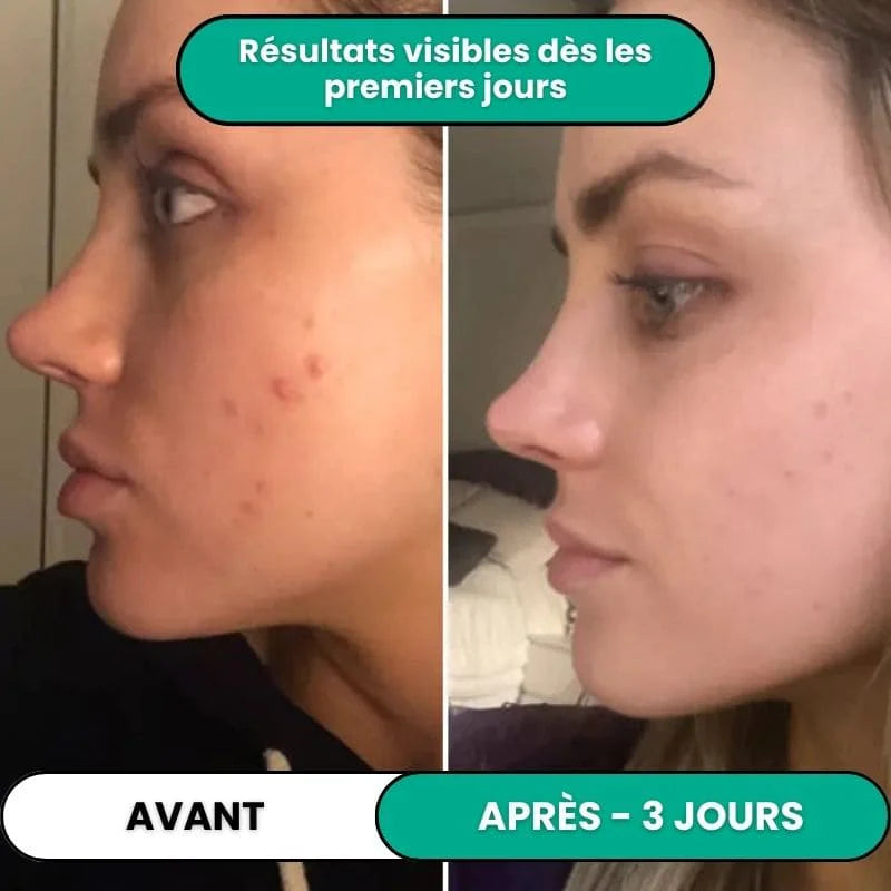 Soin Haute Fréquence